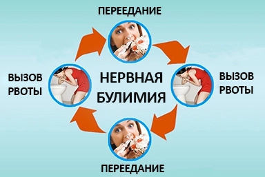 Лечение булимии в Изобильном